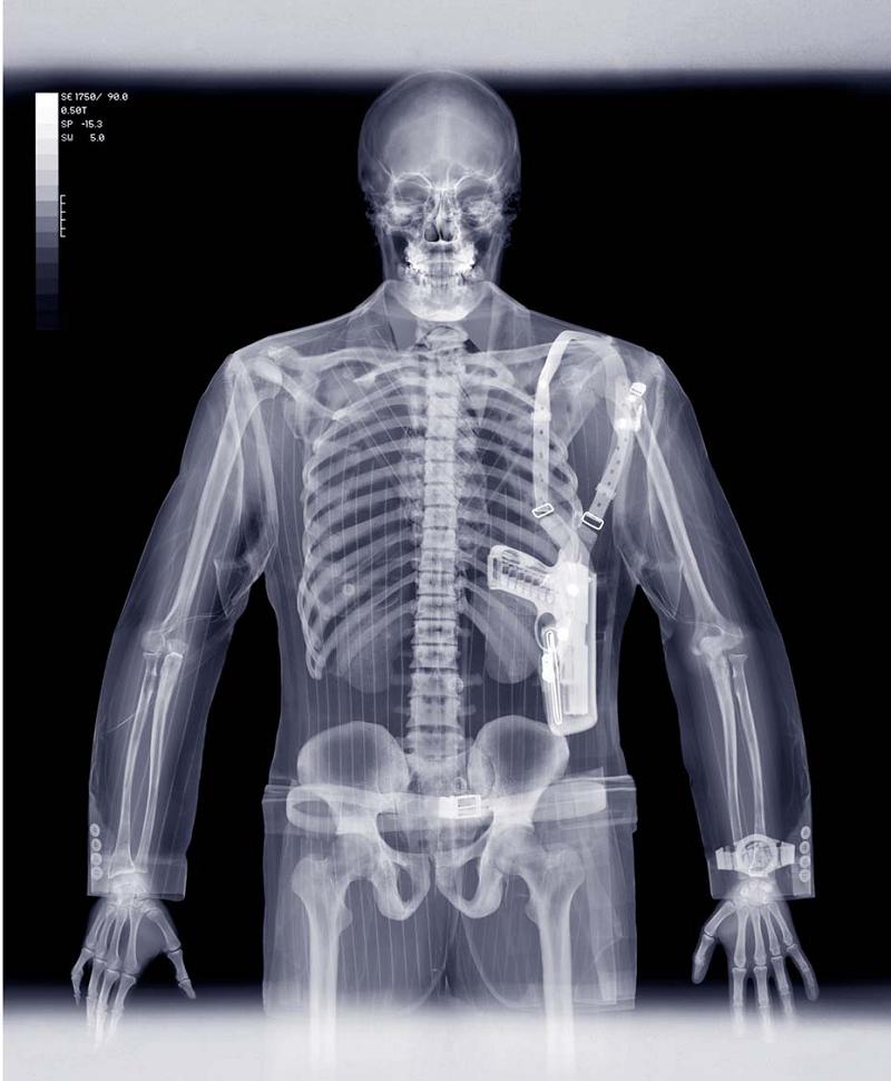 x-ray